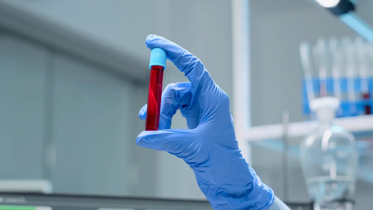 Tubo de análises ao sangue